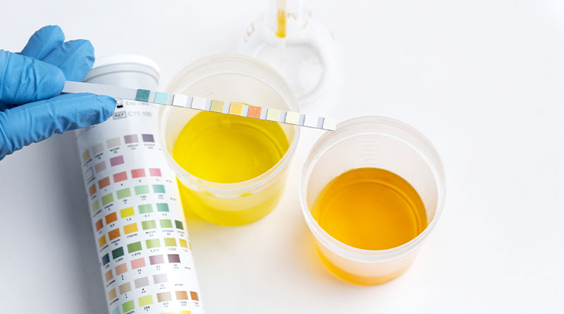 Analysis of Synthetic Urine