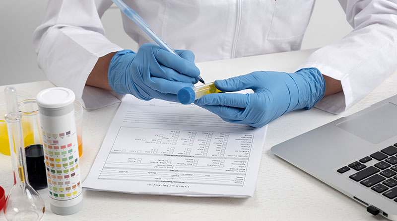 How to Pass Urine Drug Test: Tips and Tricks You Need to Know