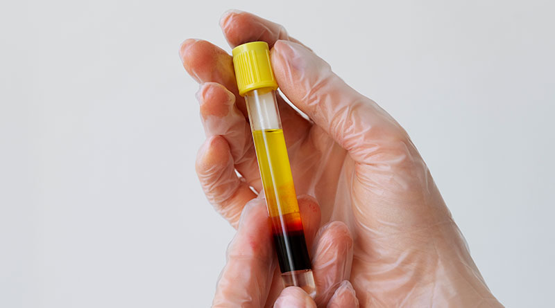 How Long Does Wax Pen Stay In Urine?