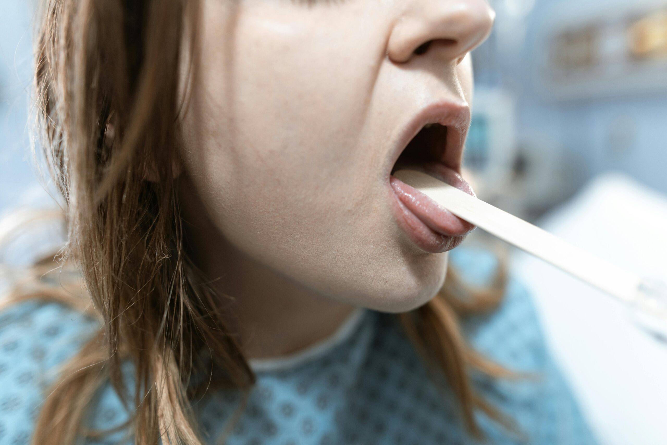 strep throat symptoms